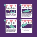Platypus Orthodontic Flossers for Braces, 40 Count (Pack of 1) - Image 3