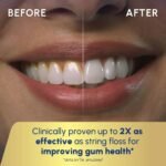 Waterpik Ultra Water Flosser - White - Image 6